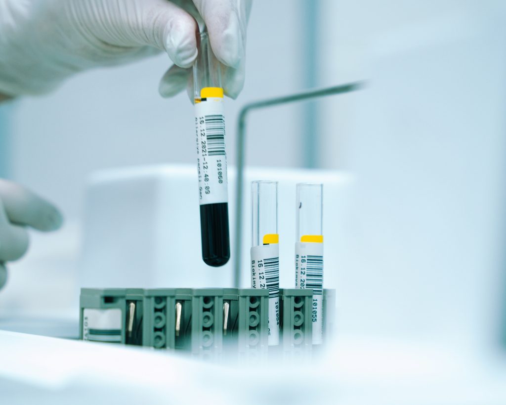 conservar-cepas-bacterianas